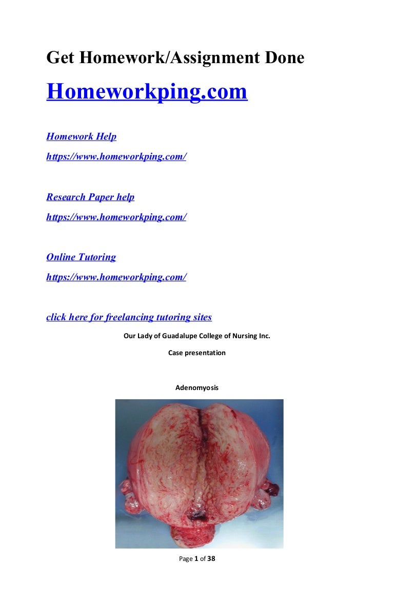 Adenomyosis - what is it And how to treat it Adenomyosis - what is it And how to treat it